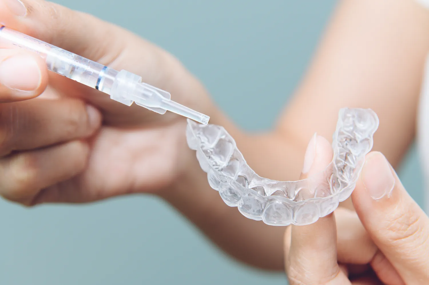 Aparat nakładkowy Invisalign Warszawa post thumbnail image